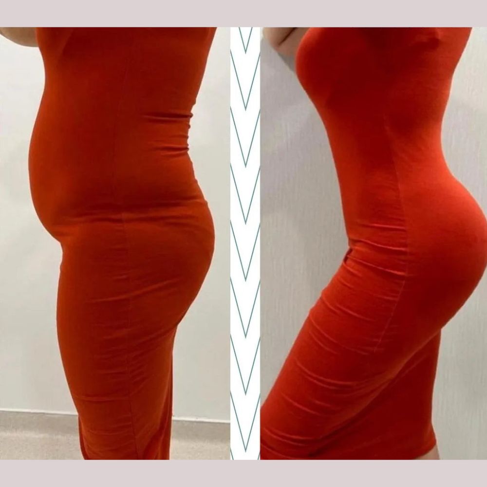 Antes y depois con calzón moldeador pêssego, mostra moldeado elegante y comodidad incomparável em vestido rojo.