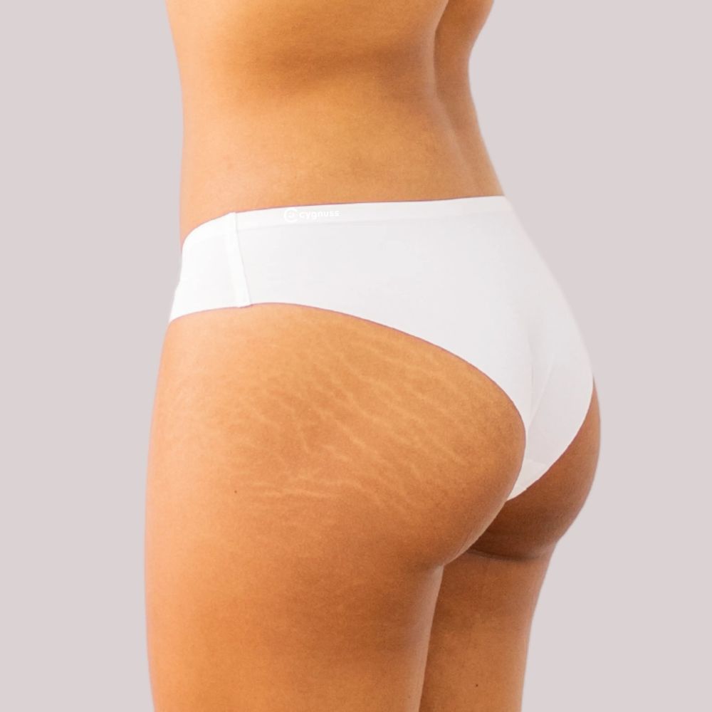 Vista lateral da região do quadril de uma mulher usando uma calzón fio-dental branca sin costuras da Cygnuss. A imagem destaca o ajuste cómodo da peça ao corpo y a naturalidade das curvas.